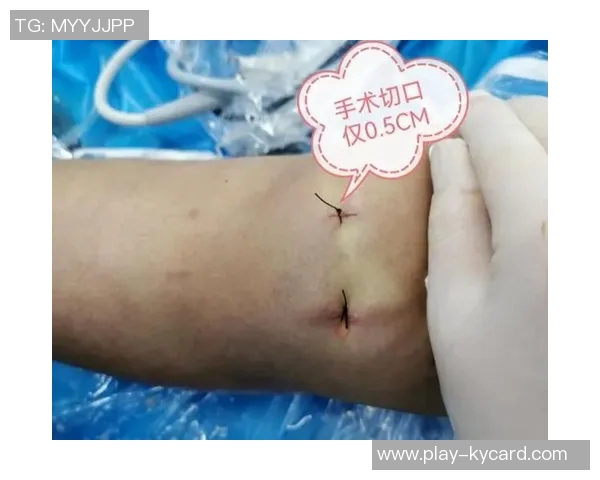 尤文图斯布雷默左膝半月板受伤将接受手术切除部分组织